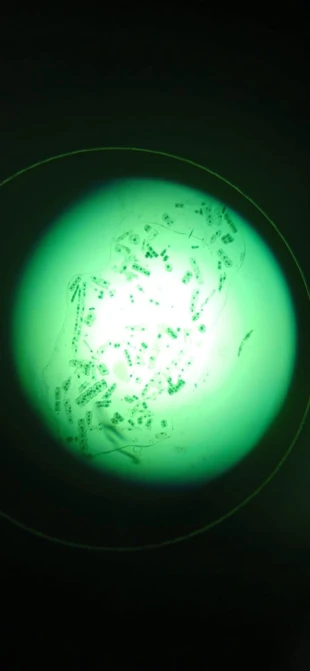 Preparat z komórką roślinną widzianą pod mikroskopem (obiektyw 40). Fot. Dawid Stanosz